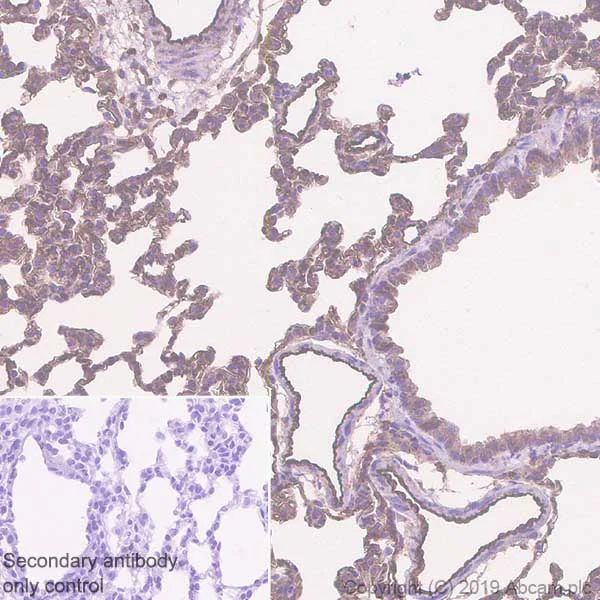 Immunohistochemistry (Formalin/PFA-fixed paraffin-embedded sections) - Anti-EHD1 antibody [EPR4954] (AB109311)