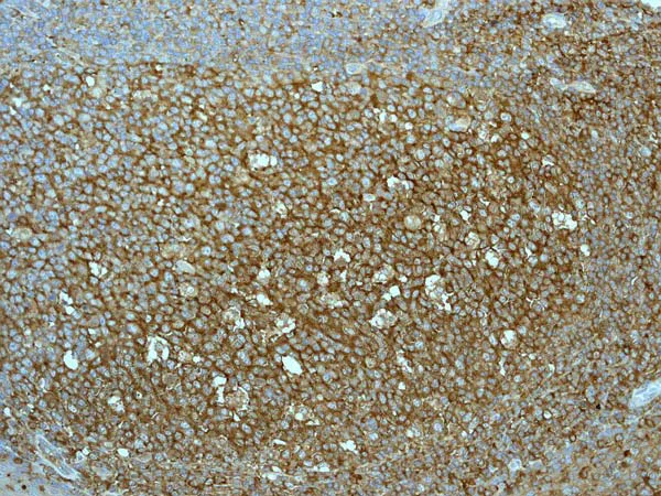 Immunohistochemistry (Formalin/PFA-fixed paraffin-embedded sections) - Anti-EHD1 antibody [EPR4954] - BSA and Azide free (AB239966)