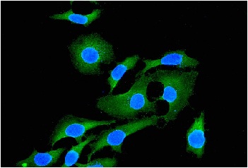 Immunocytochemistry/ Immunofluorescence - Anti-EHD1 antibody [EPR4955] (AB109747)