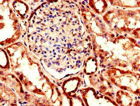 Immunohistochemistry (Formalin/PFA-fixed paraffin-embedded sections) - Anti-EHD2 antibody (AB222888)