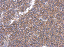 Immunohistochemistry (Formalin/PFA-fixed paraffin-embedded sections) - Anti-EHD4 antibody (AB153892)