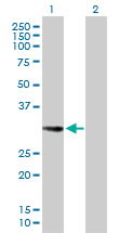 Western blot - Anti-EHF antibody (AB167264)