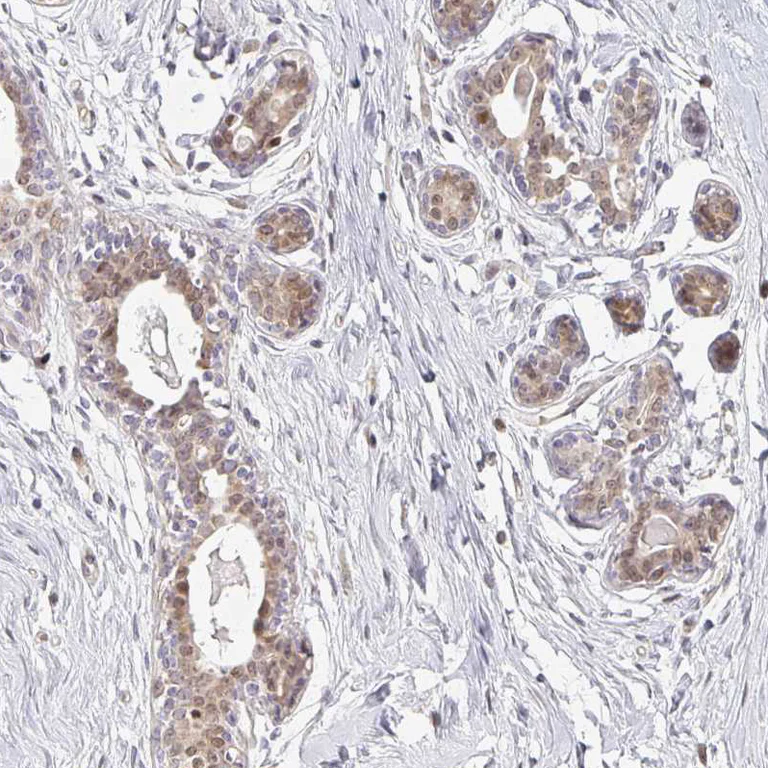 Immunohistochemistry (Formalin/PFA-fixed paraffin-embedded sections) - Anti-EHF antibody (AB272671)
