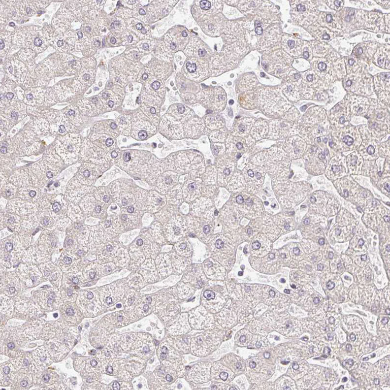 Immunohistochemistry (Formalin/PFA-fixed paraffin-embedded sections) - Anti-EHF antibody (AB272671)