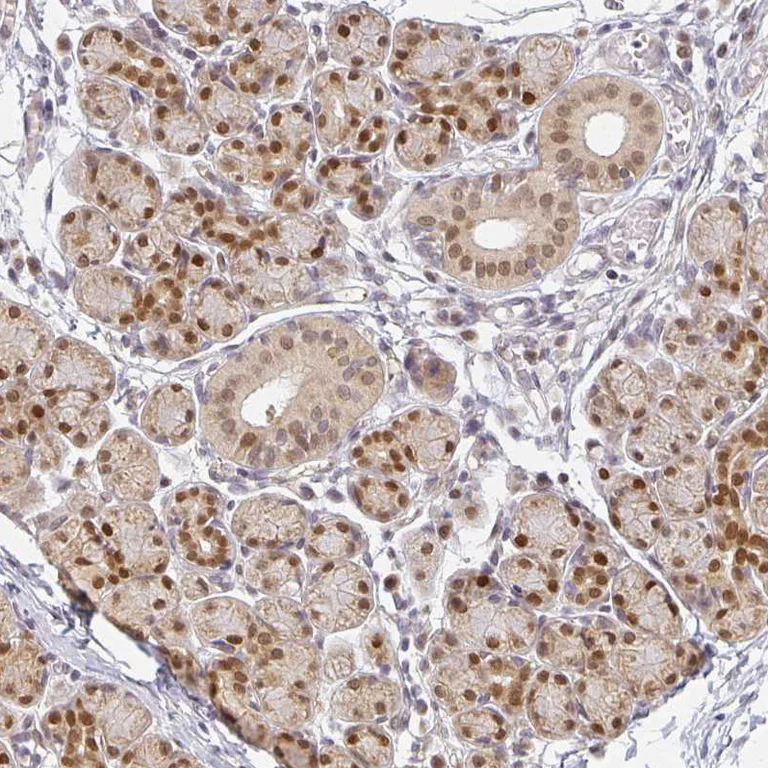 Immunohistochemistry (Formalin/PFA-fixed paraffin-embedded sections) - Anti-EHF antibody (AB272671)