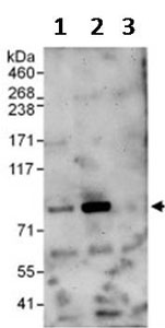 Immunoprecipitation - Anti-EHHADH antibody (AB123490)