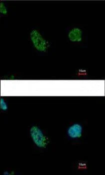 Immunocytochemistry/ Immunofluorescence - Anti-EHMT2/G9A antibody (AB183889)
