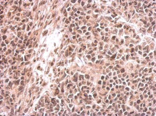 Immunohistochemistry (Formalin/PFA-fixed paraffin-embedded sections) - Anti-EHMT2/G9A antibody (AB183889)
