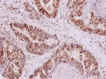 Immunohistochemistry (Formalin/PFA-fixed paraffin-embedded sections) - Anti-EHMT2/G9A antibody (AB183889)