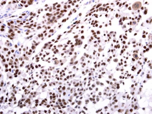 Immunohistochemistry (Formalin/PFA-fixed paraffin-embedded sections) - Anti-EHMT2/G9A antibody (AB229455)