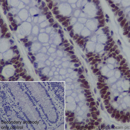 Immunohistochemistry (Formalin/PFA-fixed paraffin-embedded sections) - Anti-EHMT2/G9A antibody [EPR18894] - ChIP Grade (ab185050), expandable thumbnail