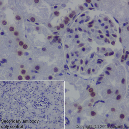 Anti-EHMT2/G9A antibody [EPR18894] - ChIP Grade (ab185050