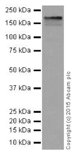 Western blot - Anti-EHMT2/G9A+EHMT1/GLP antibody [EPR18667] - BSA and Azide free (AB251187)