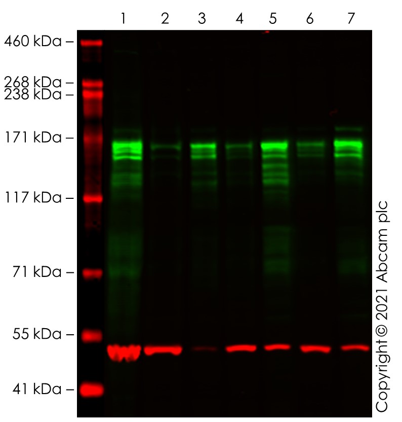 Western blot - Anti-EHMT2/G9A+EHMT1/GLP antibody [EPR18667] - BSA and Azide free (AB251187), expandable thumbnail