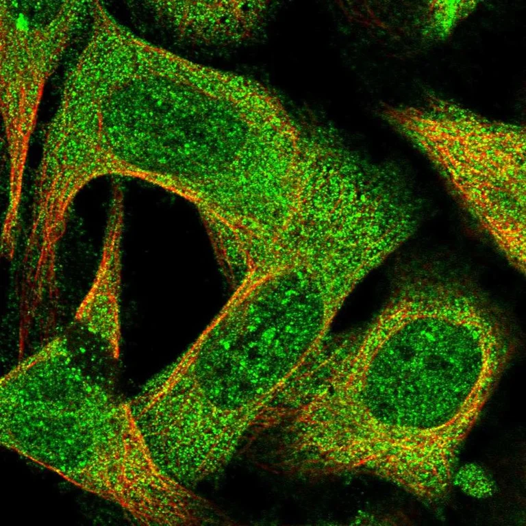 Immunocytochemistry/ Immunofluorescence - Anti-EI2BL/MRI1 antibody (AB187894)