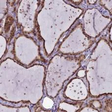 Immunohistochemistry (Formalin/PFA-fixed paraffin-embedded sections) - Anti-EI2BL/MRI1 antibody (AB187894)