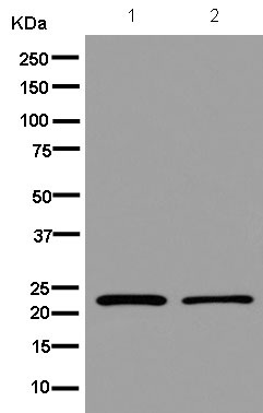 Western blot - Anti-EID1 antibody [EPR13636] (AB180133), expandable thumbnail