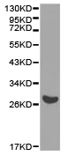 Western blot - Anti-eIF-6 antibody (AB175383)