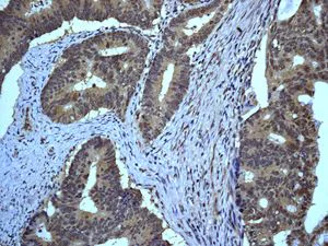 Immunohistochemistry (Formalin/PFA-fixed paraffin-embedded sections) - Anti-eIF-6 antibody [EPR6512(B)] (AB124839)