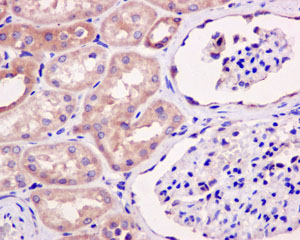 Immunohistochemistry (Formalin/PFA-fixed paraffin-embedded sections) - Anti-eIF1A antibody [EPR12466(B)] - BSA and Azide free (ab243919), expandable thumbnail