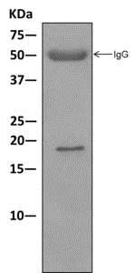 Immunoprecipitation - Anti-eIF1A antibody [EPR12467] - BSA and Azide free (AB249716)