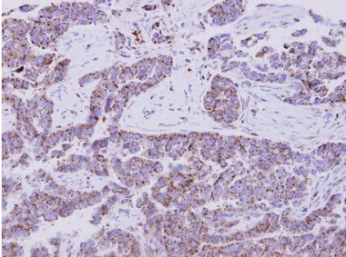 Immunohistochemistry (Formalin/PFA-fixed paraffin-embedded sections) - Anti-EIF1AY antibody (AB155546)