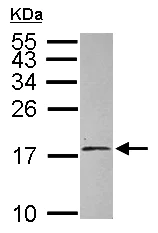 Western blot - Anti-EIF1AY antibody (AB155546)