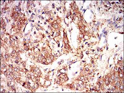 Immunohistochemistry (Formalin/PFA-fixed paraffin-embedded sections) - Anti-eIF2A antibody [3A7B11] (ab181467), expandable thumbnail