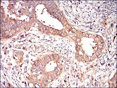 Immunohistochemistry (Formalin/PFA-fixed paraffin-embedded sections) - Anti-eIF2A antibody [3A7B11] (AB181467)
