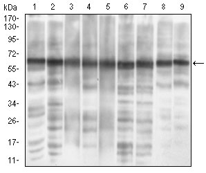 Western blot - Anti-eIF2A antibody [3A7B11] (AB181467), expandable thumbnail