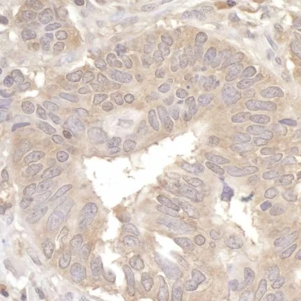 Immunohistochemistry (Formalin/PFA-fixed paraffin-embedded sections) - Anti-eIF2A antibody (AB264253)