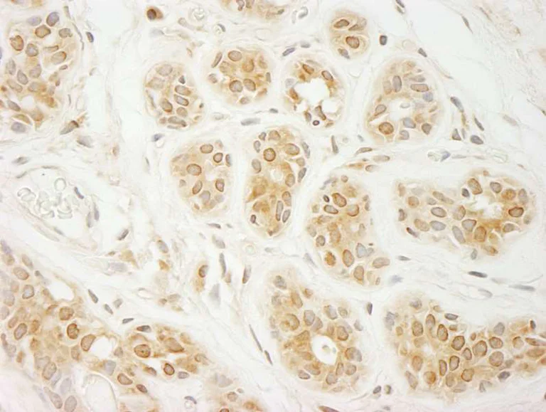 Immunohistochemistry (Formalin/PFA-fixed paraffin-embedded sections) - Anti-eIF2A antibody (AB264254)