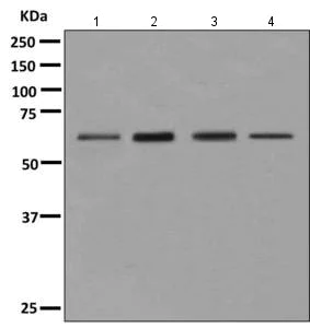 Western blot - Anti-eIF2A antibody [EPR11041] (AB157478)