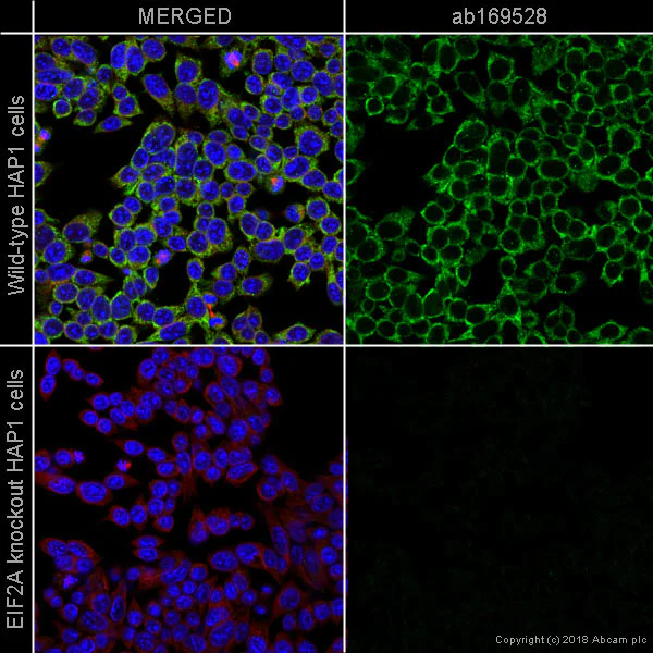 Immunocytochemistry/ Immunofluorescence - Anti-eIF2A antibody [EPR11042] (AB169528)