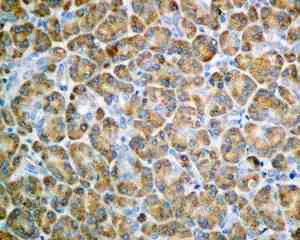Immunohistochemistry (Formalin/PFA-fixed paraffin-embedded sections) - Anti-eIF2A antibody [EPR11042] (AB169528)