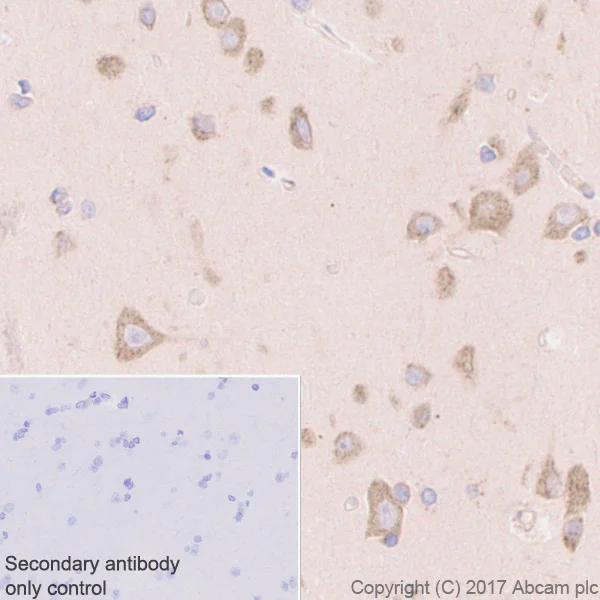 Immunohistochemistry (Formalin/PFA-fixed paraffin-embedded sections) - Anti-eIF2A antibody [EPR11042] (AB169528)
