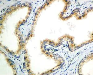 Immunohistochemistry (Formalin/PFA-fixed paraffin-embedded sections) - Anti-eIF2A antibody [EPR11042] (AB169528)