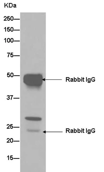 Western blot - Anti-EIF2B1 antibody [EPR13894(B)] (AB181186)