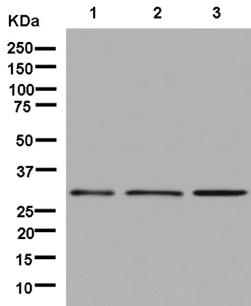 Western blot - Anti-EIF2B1 antibody [EPR13894(B)] (AB181186)
