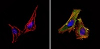 Immunocytochemistry/ Immunofluorescence - Anti-eIF2B3 antibody [1H3] (AB171093)