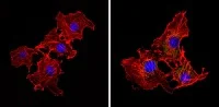 Immunocytochemistry/ Immunofluorescence - Anti-eIF2B3 antibody [1H3] (AB171093)