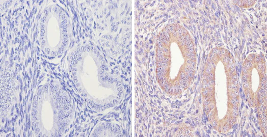 Immunohistochemistry (Formalin/PFA-fixed paraffin-embedded sections) - Anti-eIF2B3 antibody [1H3] (AB171093)