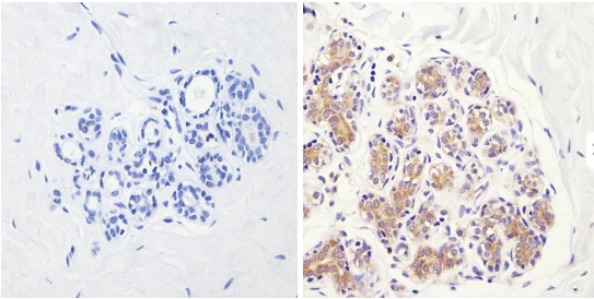 Immunohistochemistry (Formalin/PFA-fixed paraffin-embedded sections) - Anti-eIF2B3 antibody [1H3] (AB171093)