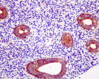 Immunohistochemistry (Formalin/PFA-fixed paraffin-embedded sections) - Anti-EIF2B5 antibody [EPR13533] (AB181033)