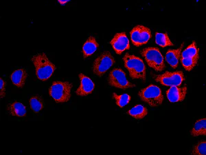 Immunocytochemistry/ Immunofluorescence - Anti-EIF2B5 antibody [EPR13533] - BSA and Azide free (AB250298)