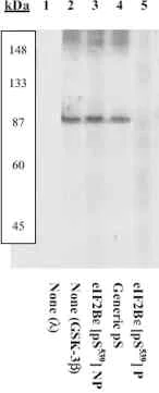 Western blot - Anti-EIF2B5 (phospho S539) antibody (AB4775)