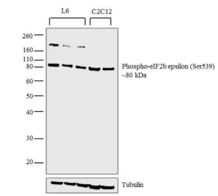 Western blot - Anti-EIF2B5 (phospho S539) antibody (AB4775)