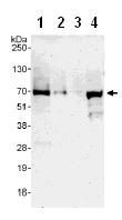 Western blot - Anti-EIF2D antibody (AB108218), expandable thumbnail