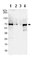 Western blot - Anti-EIF2D antibody (AB108218)