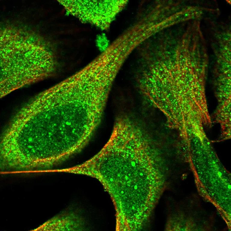 Immunocytochemistry/ Immunofluorescence - Anti-EIF2D antibody (AB251784)